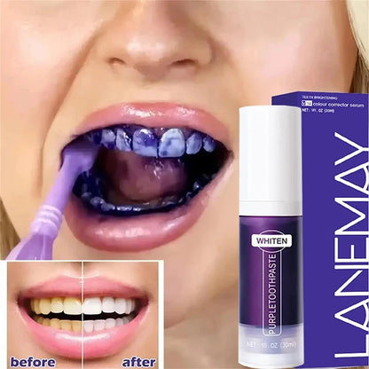Teeth Whitening Toothpaste Opaline Teeth Stick