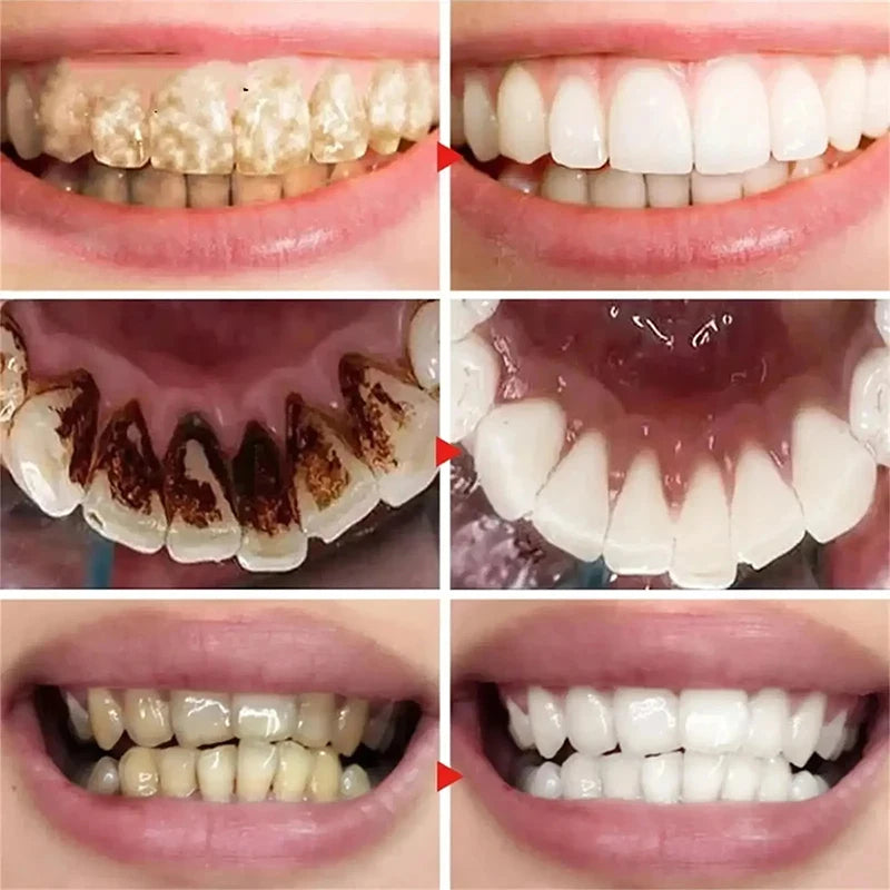 Teeth Whitening Toothpaste Opaline Teeth Stick