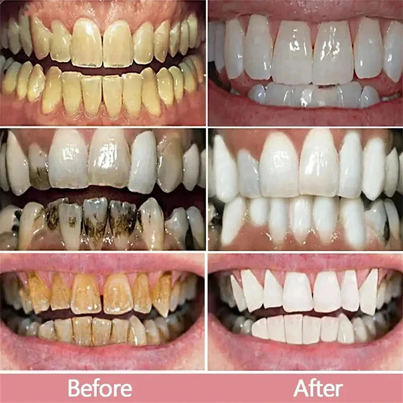Teeth Whitening Toothpaste Opaline Teeth Stick