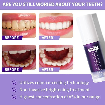Teeth Whitening Toothpaste Opaline Teeth Stick